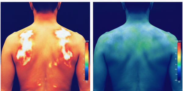 Earthing e Grounding: Il Potente Antinfiammatorio Naturale contro il Dolore